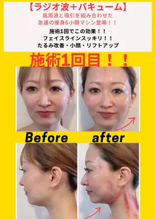 毛穴フェイシャル エステ専門店BBのエステ・リラクイメージ