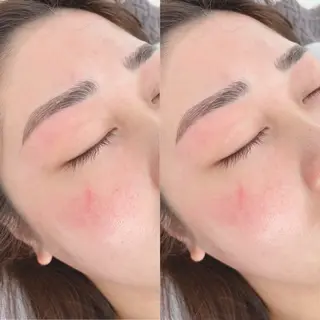 LOARY所属・LOARY 五日市店のネイルデザイン