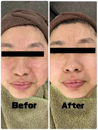 Beauty  Salon Laki所属・Beauty salon Lakiのエステ・リラクイメージ