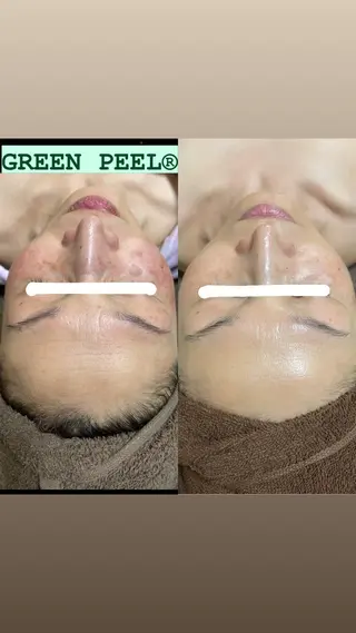 brilliance所属・老化肌トラブル肌専門 Brillianceのエステ・リラクイメージ