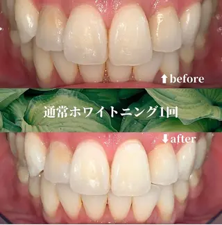 futaba ホワイトニング/天神のエステ・リラクイメージ