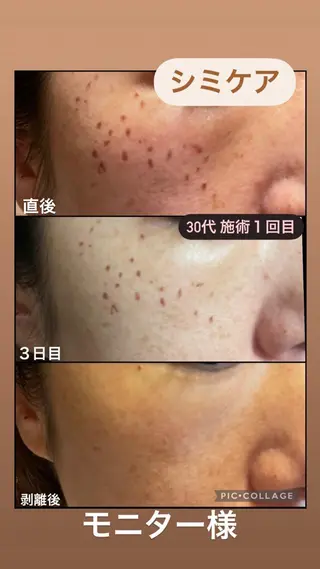 ANGEL NAIL所属・RE:BORN 大阪四條畷市のエステ・リラクイメージ