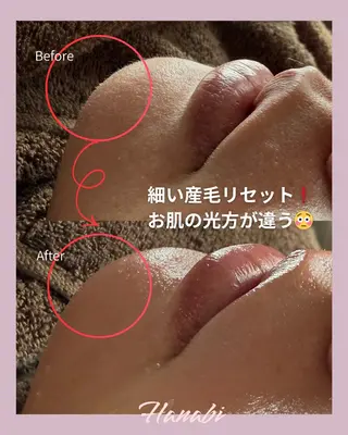 毛穴専門サロン Hanabiのエステ・リラクイメージ