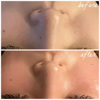 メンズ メナード岐阜市茜部 杉浦のエステ・リラクイメージ