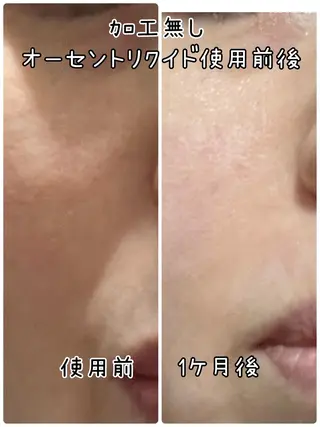 【安心ハンドテク】 メナード富田丘のエステ・リラクイメージ