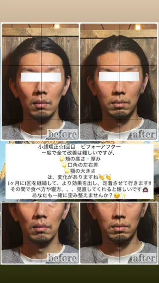 💎後悔させない小顔 矯正💎イトヤマ🌱のエステ・リラクイメージ