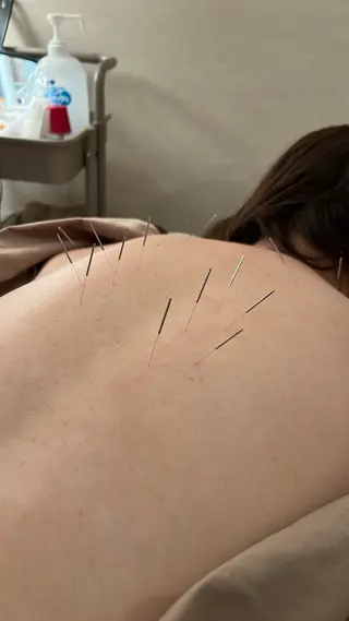 美容鍼灸整体院 ハリノヒ大阪院のエステ・リラクイメージ