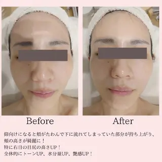 PRETTIEST SHINE所属・フェイシャル/ボディ /ブライダル山田浩子のエステ・リラクイメージ