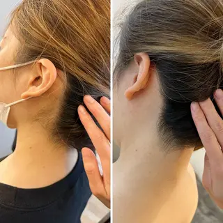 うなじ脱毛/美肌脱毛 LABELのエステ・リラクイメージ