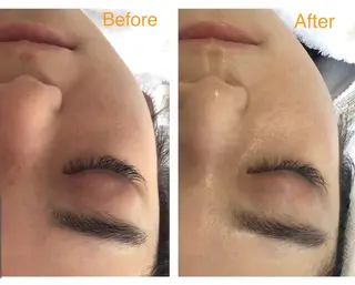 子宮矯正/腸揉み/ シュガーリング脱毛のエステ・リラクイメージ