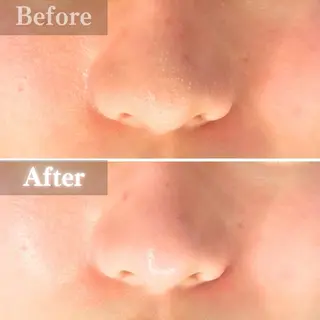 毛穴洗浄特化🫧 オオツカのエステ・リラクイメージ