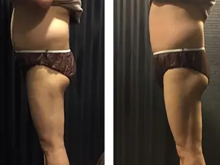 横浜エステサロン R-ing　リングのエステ・リラクイメージ