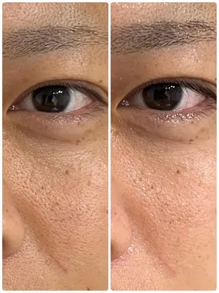 小顔・ツルツル素肌 ハリステリアのエステ・リラクイメージ