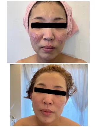 BLESS BEAUTYのエステ・リラクイメージ