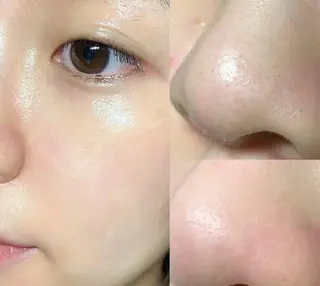 ネイル aliaハイフ&水光ジェットサロン所属・aliaハーブ水光店 エステティシャン募集のエステ・リラクイメージ