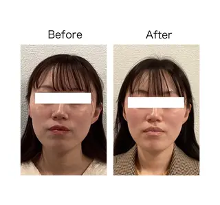 小顔サロンSharp …腸調整よもぎ蒸しのエステ・リラクイメージ