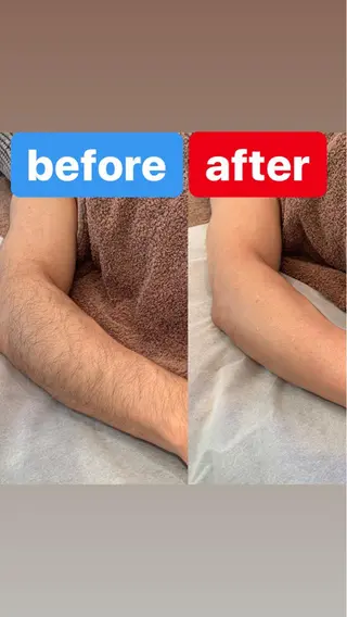 メンズ BRUSH  BODY所属・男性施術者による 光脱毛×ワックス脱毛のエステ・リラクイメージ