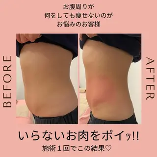 脂肪冷却・脱毛サロン coconoix のエステ・リラクイメージ