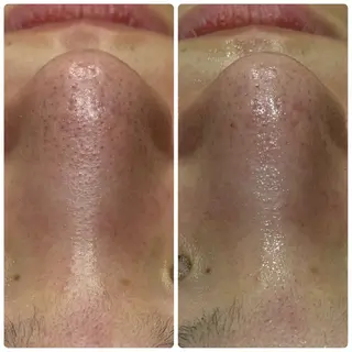 脱毛&フェイシャル 専門店muro.のエステ・リラクイメージ