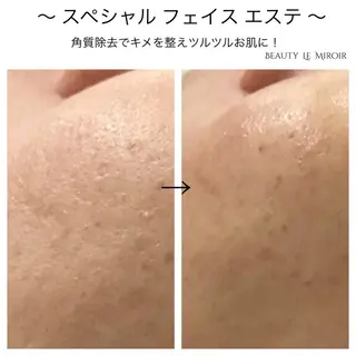 ビューティー ミロワールのエステ・リラクイメージ