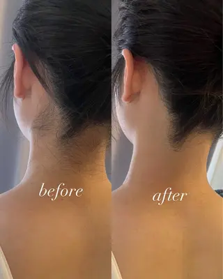 うなじ脱毛/美肌脱毛 LABELのエステ・リラクイメージ