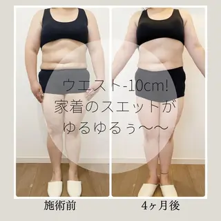 痩身＆ヘッド 長倉絵美のエステ・リラクイメージ