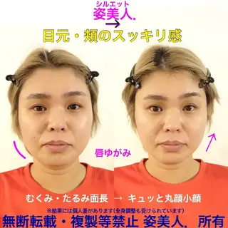 筋膜整体＆小顔矯正 　姿美人.シルエットのエステ・リラクイメージ