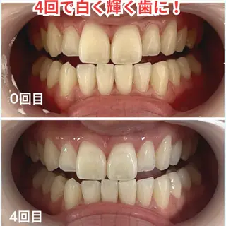 【LEPUS】レプス nishimoriのエステ・リラクイメージ