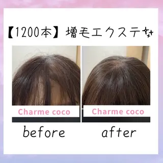 ショート メンズ 肌質改善Charme coco  増毛のエステ・リラクイメージ