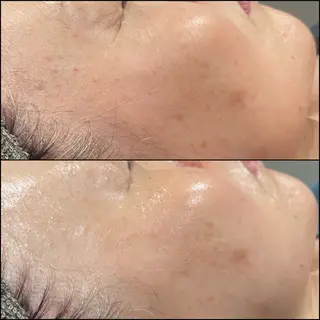 LiZA エステティックサロンのその他イメージ