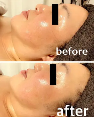 食べながら魅せボディ éclatJua川越のエステ・リラクイメージ