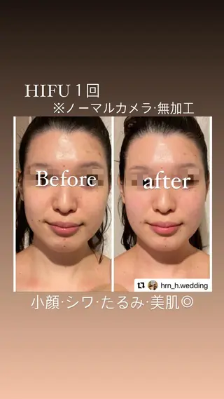 ルシール ユーのエステ・リラクイメージ