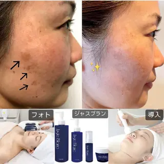 Richeka リシェカのエステ・リラクイメージ