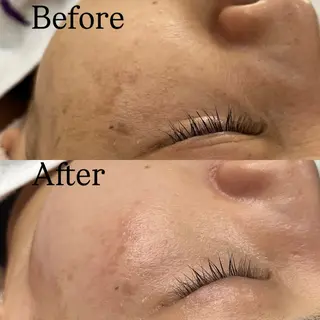 Rejue所属・永田 茜のエステ・リラクイメージ