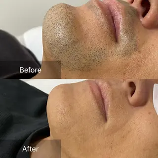 メンズ 港区都度払い脱毛 miranjuのエステ・リラクイメージ