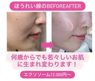 DECIDE L.A.W所属・太田 女久美のエステ・リラクイメージ