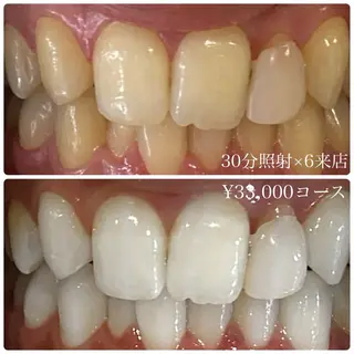 PLATINUM Beauty 横浜店所属・ホワイトニングルーム 横浜店のその他イメージ