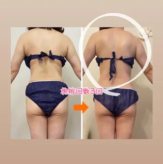 ショート カラー パーマ ヘアアレンジ メンズ キッズ ネイル マツエク・マツパ ‍痩身＆ボディ 結果出し🌟丹野のエステ・リラクイメージ