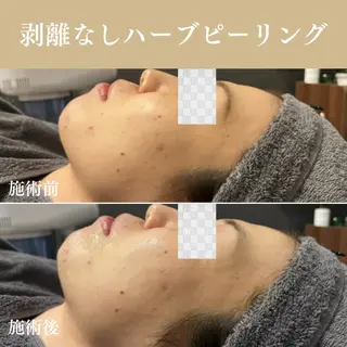Oncebell. Bodymake&beautysalon所属・Oncebell. ワンベルのエステ・リラクイメージ