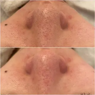 ララ/ハーブ メゾンリュバンのエステ・リラクイメージ