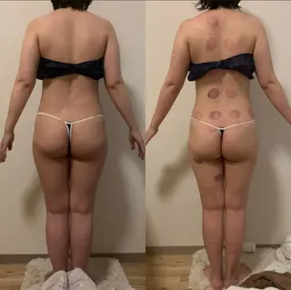 ネイル a room salonのエステ・リラクイメージ