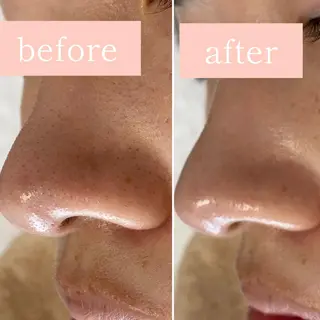 毛穴専門サロン　フルール所属・フルールFululu 自由が丘のエステ・リラクイメージ