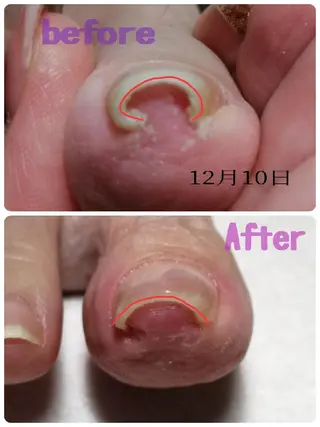 ネイル tommy's nail所属・福岡/若よもぎ蒸し 全身美容が叶うサロンのネイルデザイン