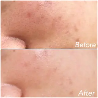 L’Beige レベージュのエステ・リラクイメージ