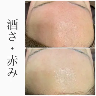 ハーブピーリング専門 BIOEL横浜のエステ・リラクイメージ