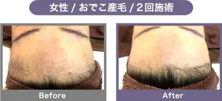 NONOKEKE ノノケケのエステ・リラクイメージ