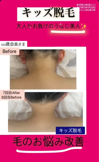 キッズ ブライダル痩身×脱毛 尼崎駅前サロンのエステ・リラクイメージ
