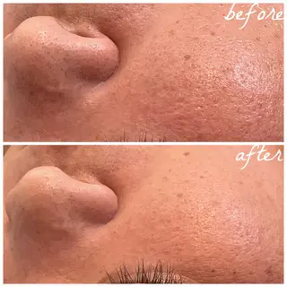 メンズ メナード岐阜市茜部 杉浦のエステ・リラクイメージ