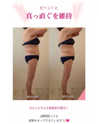 産後ダイエット−9㎏ Pourvous結衣のエステ・リラクイメージ