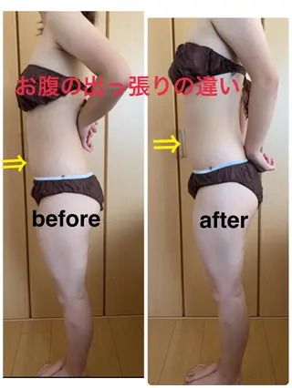 痩身/脱毛/ネイル HARUKAのエステ・リラクイメージ